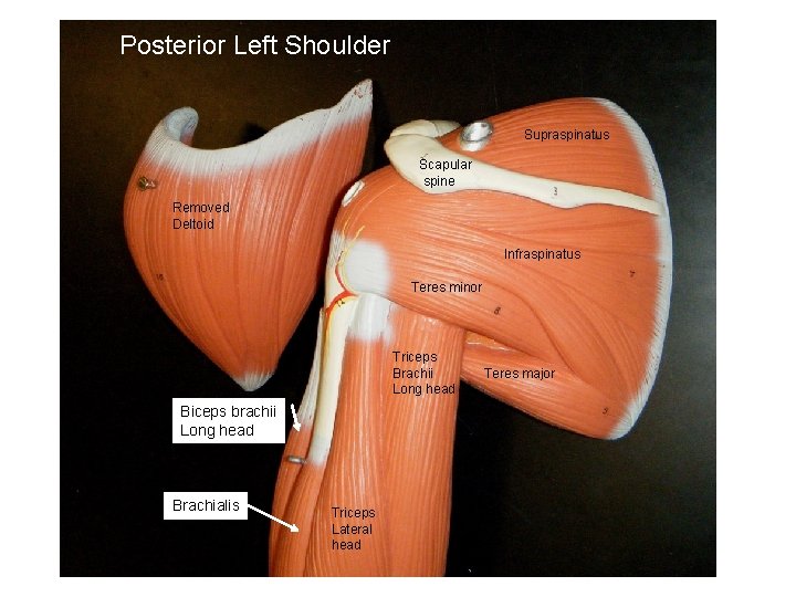 Posterior Left Shoulder Supraspinatus Scapular spine Removed Deltoid Infraspinatus Teres minor Triceps Brachii Long