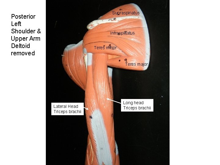 Supraspinatus Posterior Left Shoulder & Upper Arm Deltoid removed Infraspinatus Teres minor Teres major