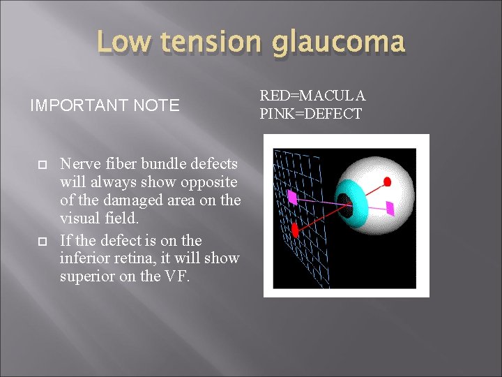 Low tension glaucoma IMPORTANT NOTE Nerve fiber bundle defects will always show opposite of