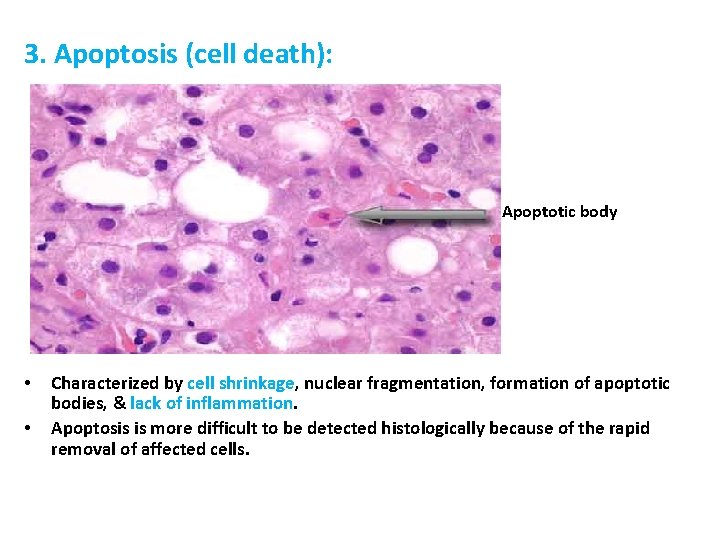 3. Apoptosis (cell death): Apoptotic body • • Characterized by cell shrinkage, nuclear fragmentation,