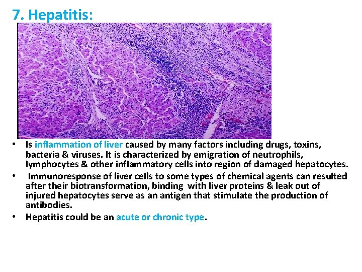7. Hepatitis: • Is inflammation of liver caused by many factors including drugs, toxins,