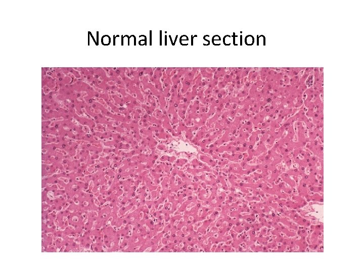 Normal liver section 