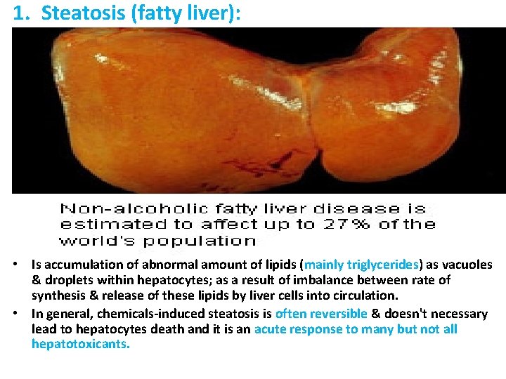 1. Steatosis (fatty liver): • Is accumulation of abnormal amount of lipids (mainly triglycerides)