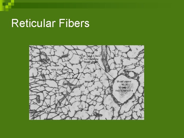 Reticular Fibers 