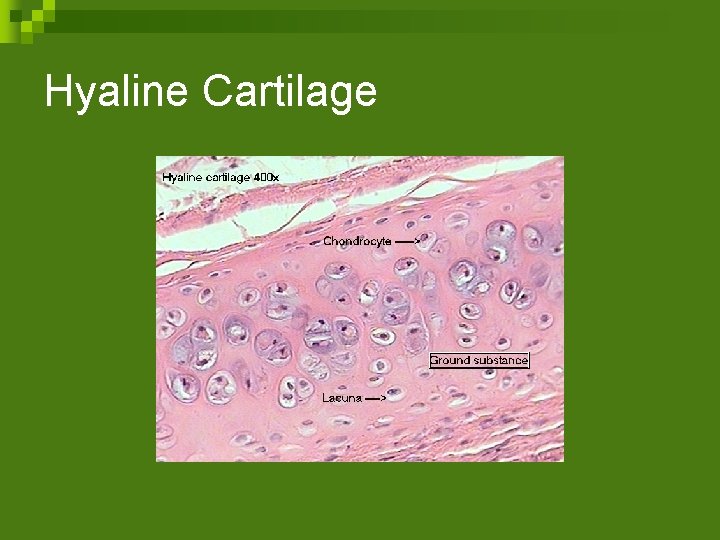 Hyaline Cartilage 