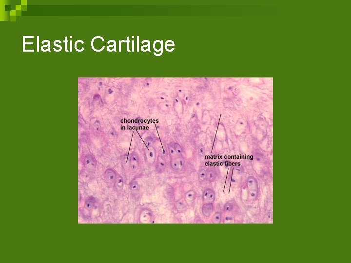 Elastic Cartilage 