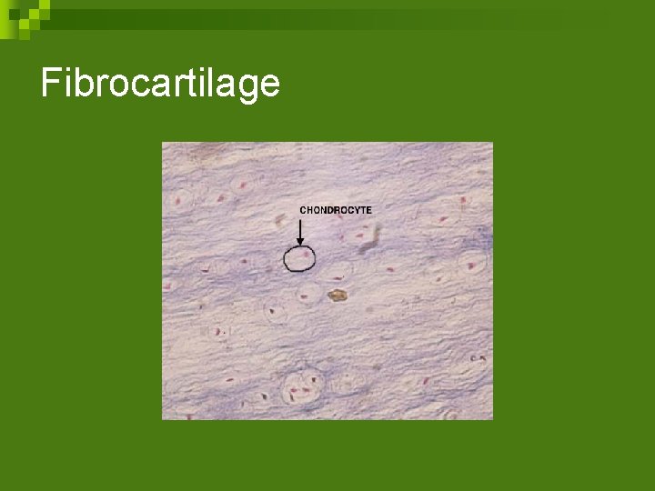 Fibrocartilage 