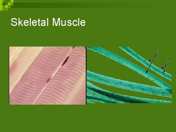 Skeletal Muscle 