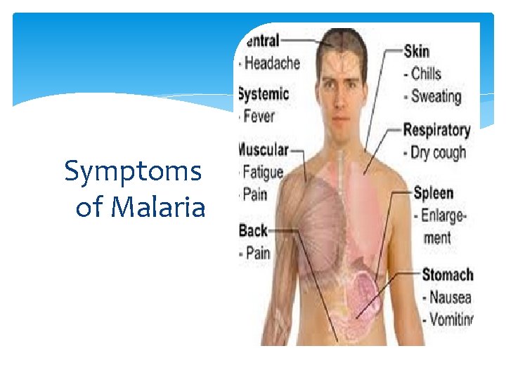 Symptoms of Malaria 