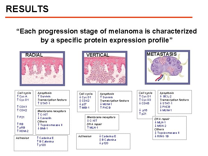 RESULTS “Each progression stage of melanoma is characterized by a specific protein expression profile”