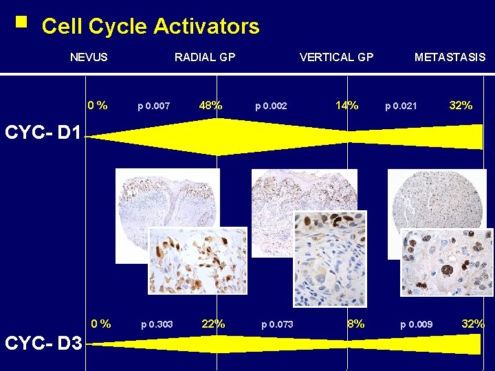Cell Cycle Activators NEVUS 0% RADIAL GP p 0. 007 48% VERTICAL GP p