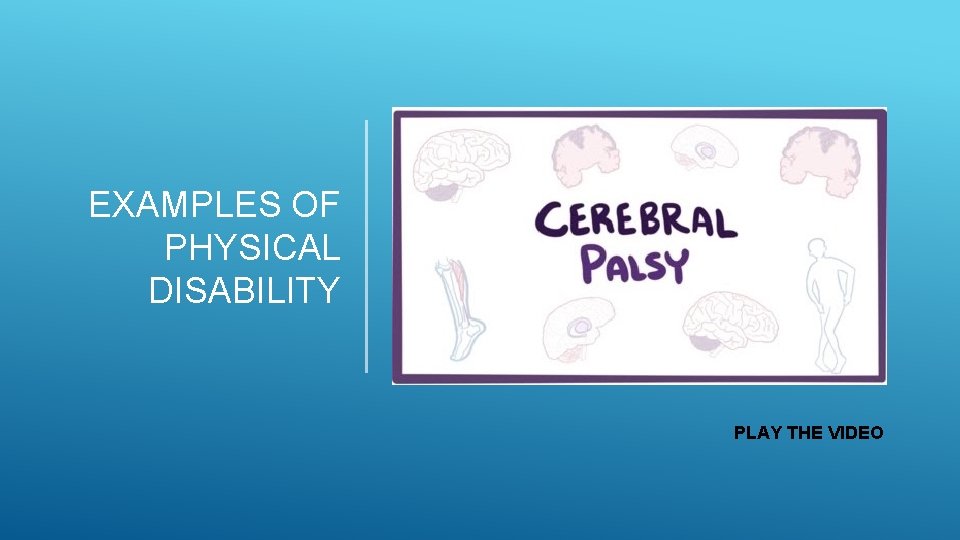 EXAMPLES OF PHYSICAL DISABILITY PLAY THE VIDEO EXAMPLES OF PHYSICAL DISABILITY PLAY THE VIDEO