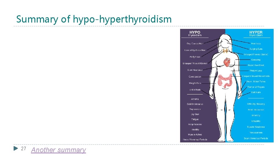 Summary of hypo-hyperthyroidism 27 Another summary 