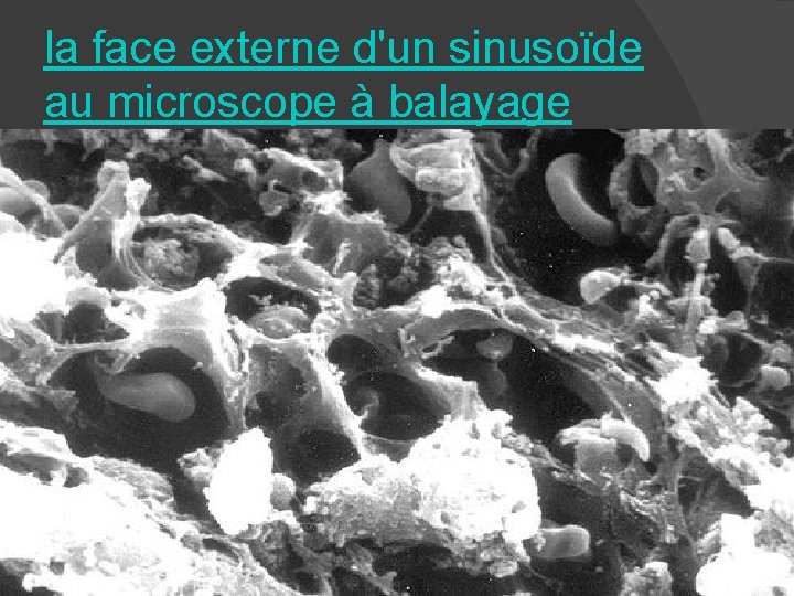 la face externe d'un sinusoïde au microscope à balayage 