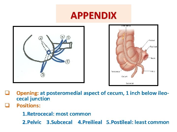 APPENDIX q q Opening: at posteromedial aspect of cecum, 1 inch below ileocecal junction