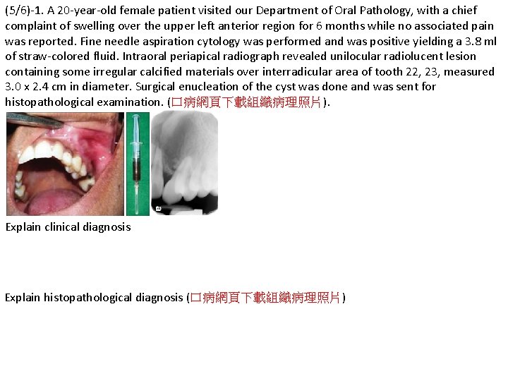 (5/6)-1. A 20 -year-old female patient visited our Department of Oral Pathology, with a