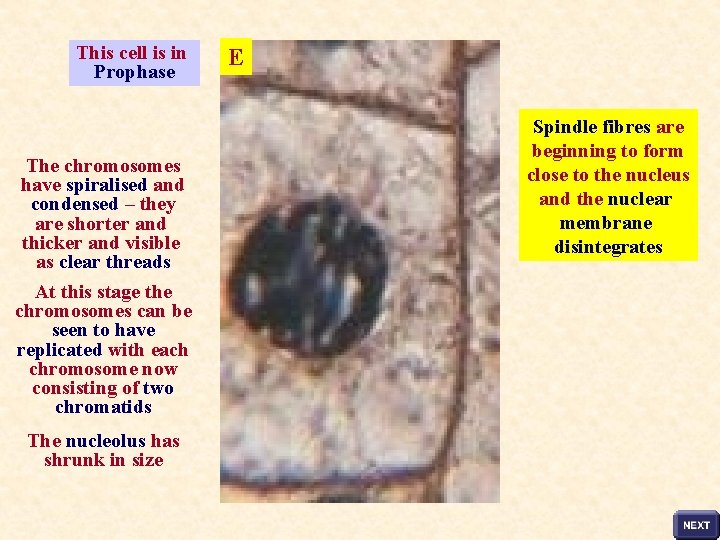 This cell is in Prophase The chromosomes have spiralised and condensed – they are