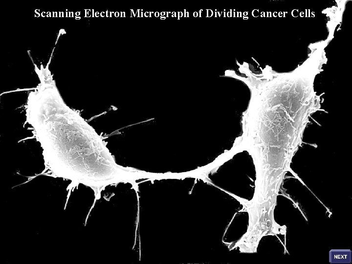 Scanning Electron Micrograph of Dividing Cancer Cells 