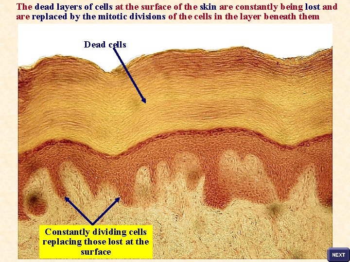 The dead layers of cells at the surface of the skin are constantly being