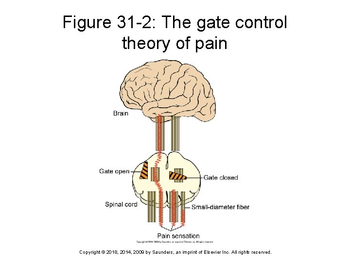 Figure 31 -2: The gate control theory of pain Copyright © 2018, 2014, 2009