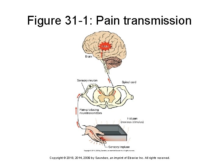 Figure 31 -1: Pain transmission Copyright © 2018, 2014, 2009 by Saunders, an imprint