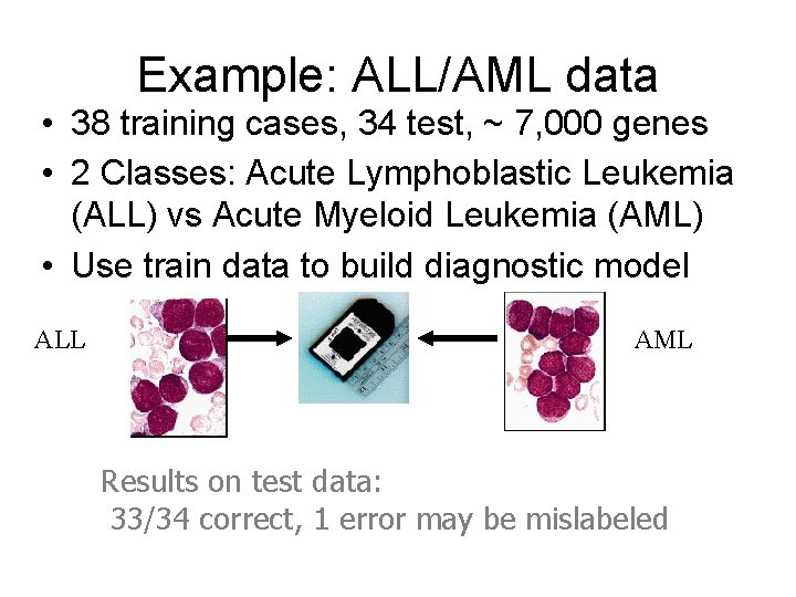 Example: ALL/AML data • 38 training cases, 34 test, ~ 7, 000 genes •