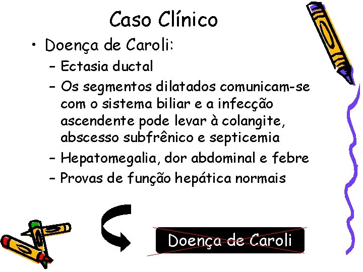 Caso Clínico • Doença de Caroli: – Ectasia ductal – Os segmentos dilatados comunicam-se
