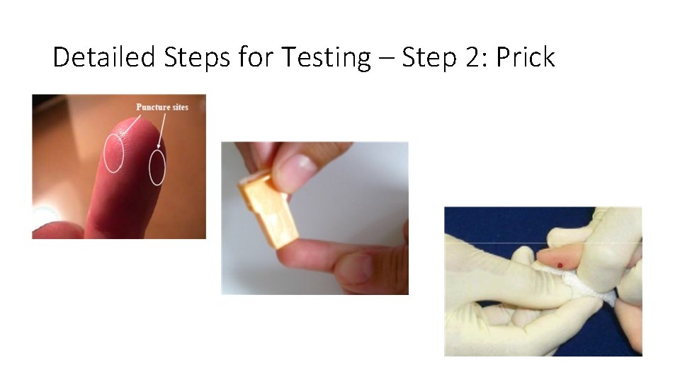 Detailed Steps for Testing – Step 2: Prick 