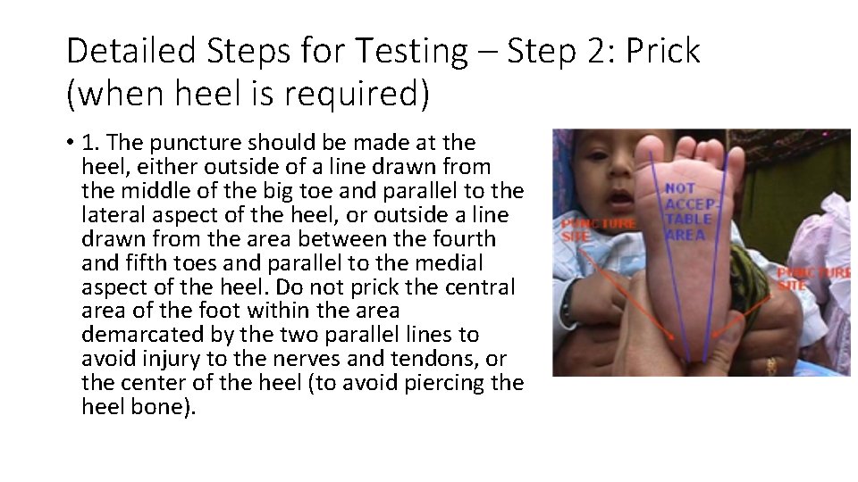 Detailed Steps for Testing – Step 2: Prick (when heel is required) • 1.