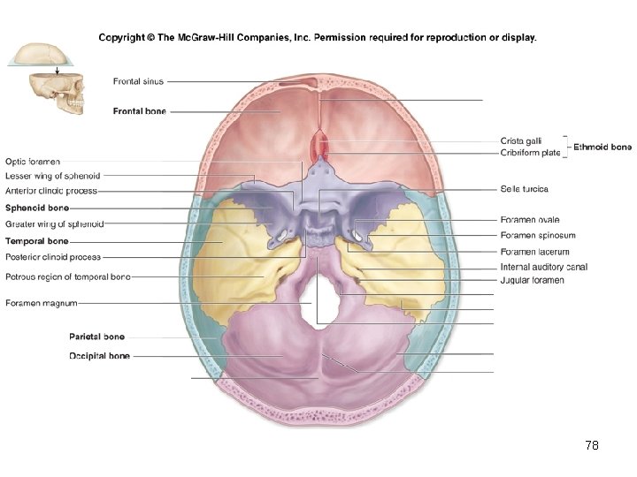 Insert Fig. 7. 9 superior view of skull 78 