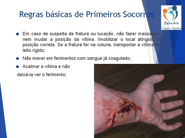 Regras básicas de Primeiros Socorros Em caso de suspeita de fratura ou luxação, não