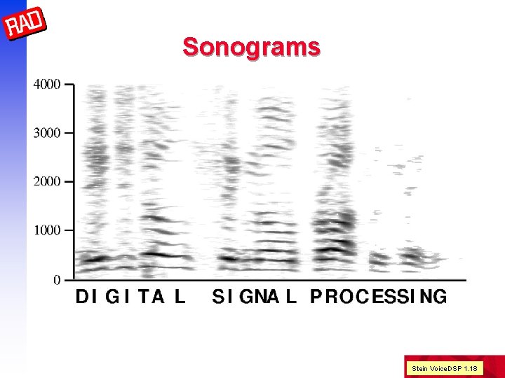 Sonograms Stein Voice. DSP 1. 18 