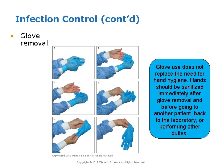 Infection Control (cont’d) • Glove removal Glove use does not replace the need for Infection Control (cont’d) • Glove removal Glove use does not replace the need for