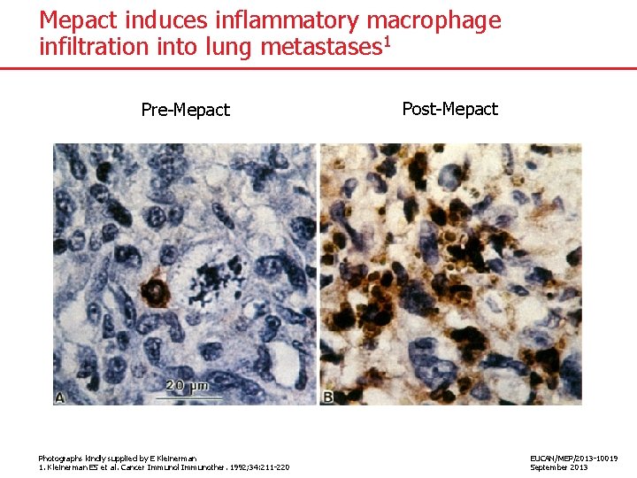 Mepact induces inflammatory macrophage infiltration into lung metastases 1 Pre-Mepact Photographs kindly supplied by