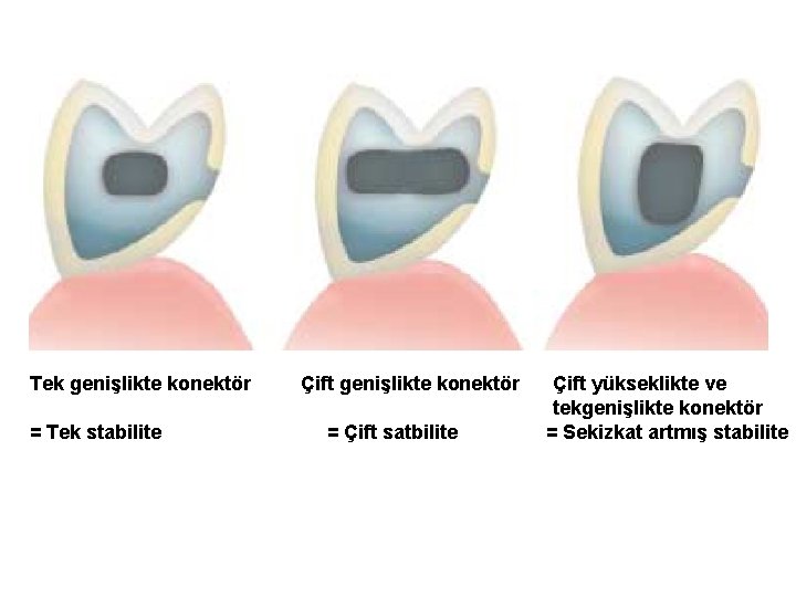 Tek genişlikte konektör = Tek stabilite Çift genişlikte konektör = Çift satbilite Çift yükseklikte