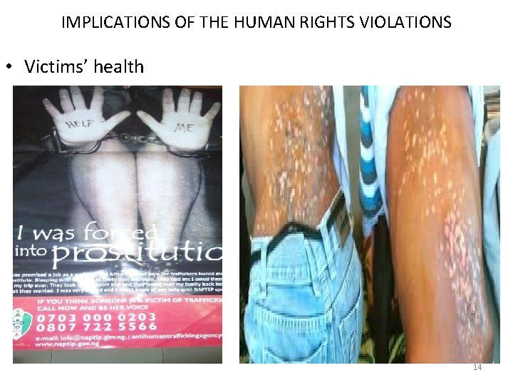 IMPLICATIONS OF THE HUMAN RIGHTS VIOLATIONS • Victims’ health 14 