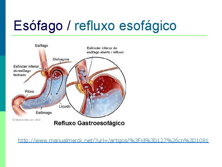 Esófago / refluxo esofágico http: //www. manualmerck. net/? url=/artigos/%3 Fid%3 D 127%26 cn%3 D