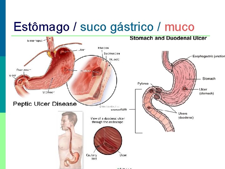 Estômago / suco gástrico / muco 