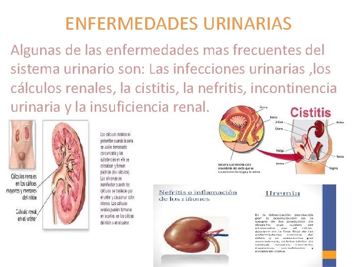 EL SISTEMA EXCRETOR En el ser humano las