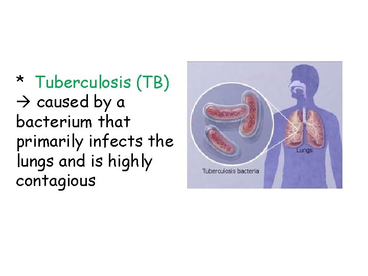 * Tuberculosis (TB) caused by a bacterium that primarily infects the lungs and is