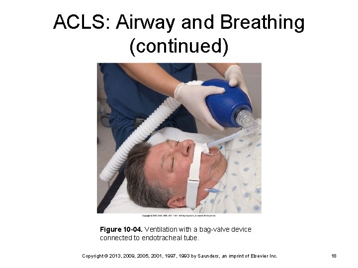 ACLS: Airway and Breathing (continued) Figure 10 -04. Ventilation with a bag-valve device connected