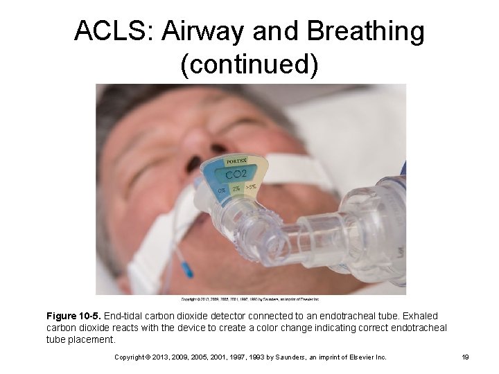 ACLS: Airway and Breathing (continued) Figure 10 -5. End-tidal carbon dioxide detector connected to