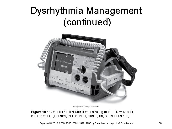 Dysrhythmia Management (continued) Figure 10 -11. Monitor/defibrillator demonstrating marked R waves for cardioversion. (Courtesy