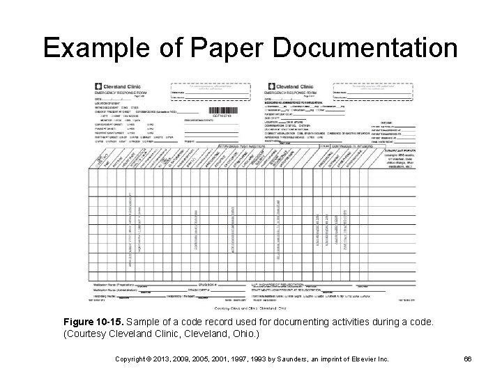 Example of Paper Documentation Figure 10 -15. Sample of a code record used for