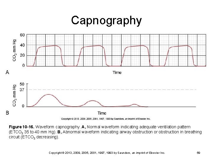 Capnography Figure 10 -16. Waveform capnography. A, Normal waveform indicating adequate ventilation pattern (ETCO