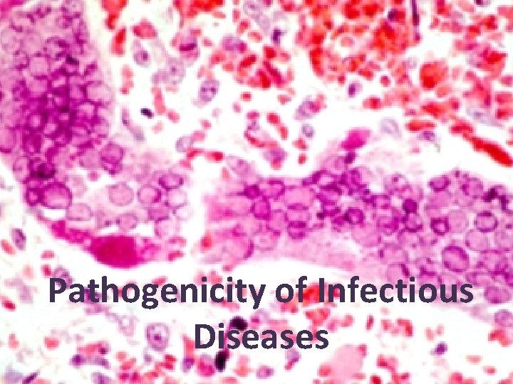 Pathogenicity of Infectious Diseases 