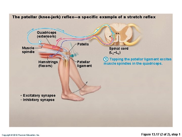 The patellar (knee-jerk) reflex—a specific example of a stretch reflex Quadriceps (extensors) 1 Muscle