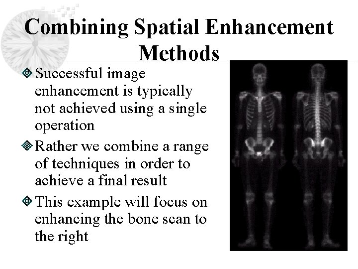 Combining Spatial Enhancement Methods Successful image enhancement is typically not achieved using a single