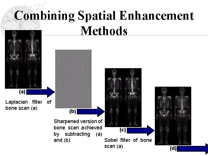 Combining Spatial Enhancement Methods (a) Laplacian filter of bone scan (a) (b) Sharpened version