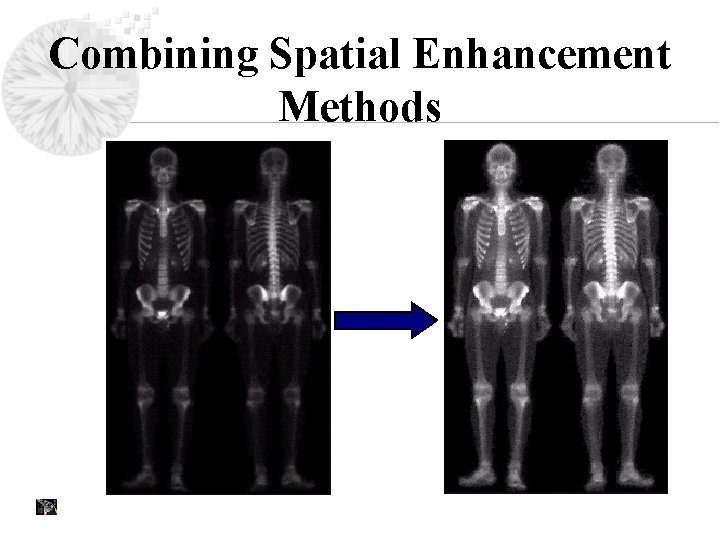 Combining Spatial Enhancement Methods 